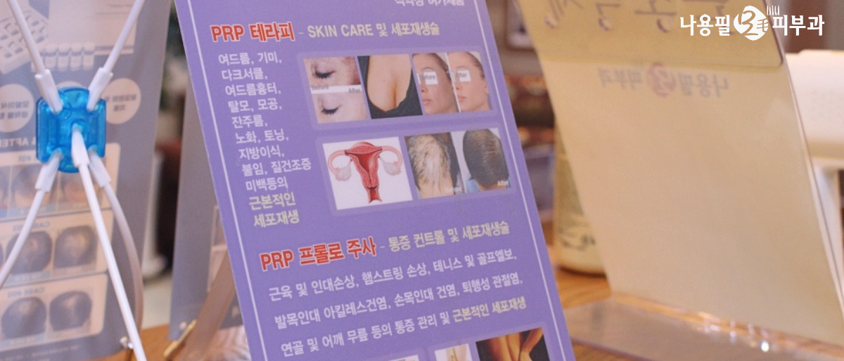 나주 탈모치료