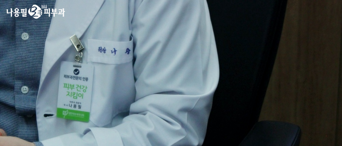 담양 탈모치료